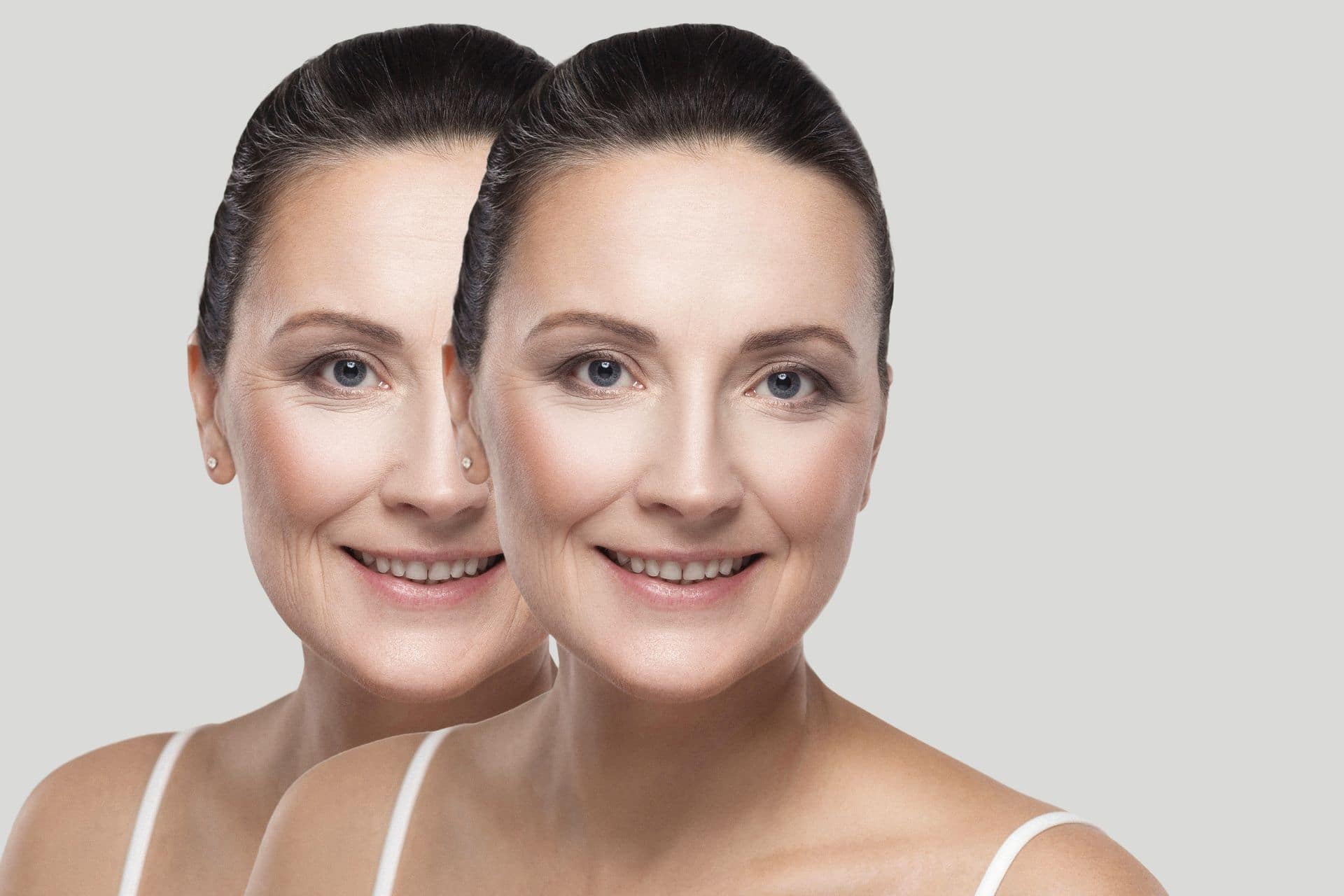 How Botox Works To Reduce The Appearance Of Wrinkles