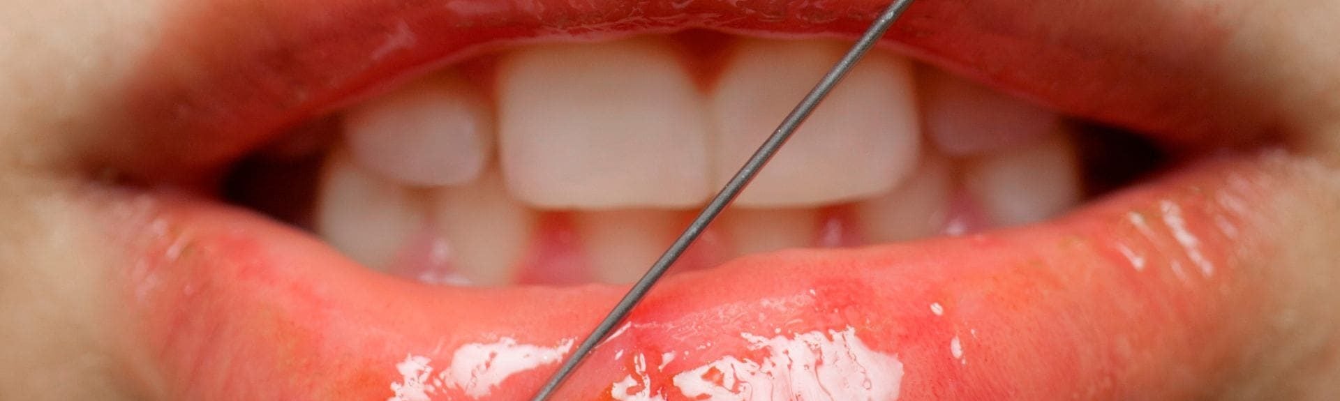 Botox Injections What Are The Risks And Side Effects