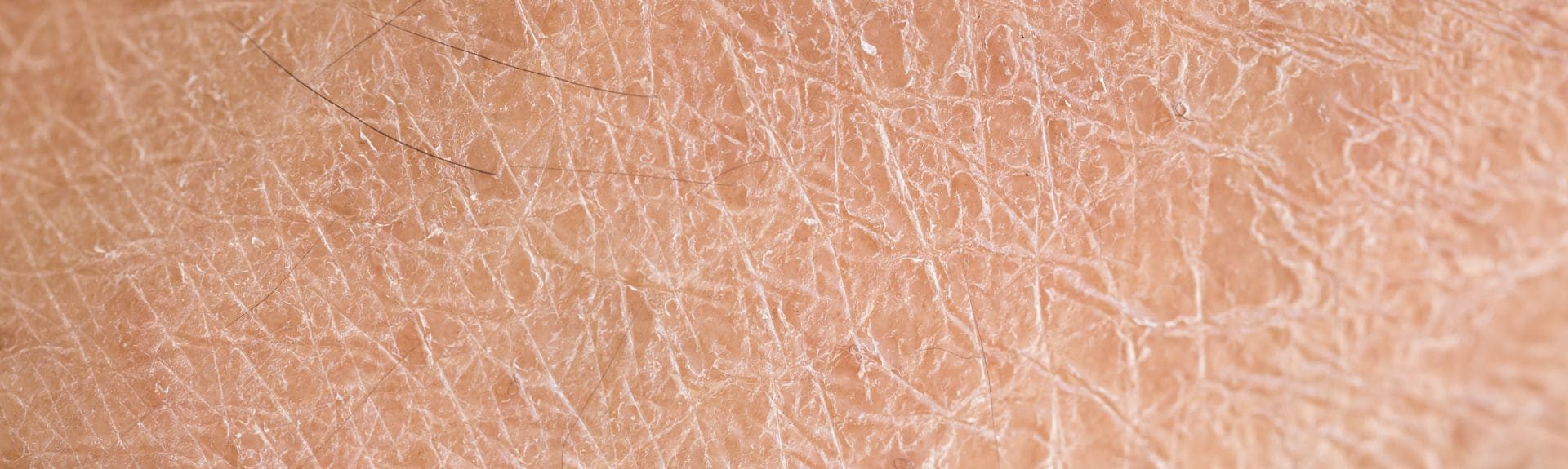Say Goodbye To Dry Skin_ Tips And Treatments